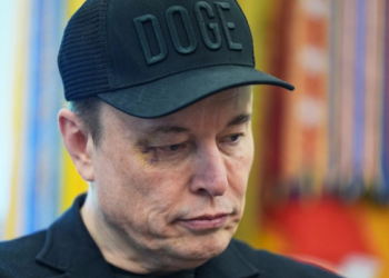 U shfaq me sy të nxirë në krah të Trump, Musk zbulon se kush e goditi me grusht