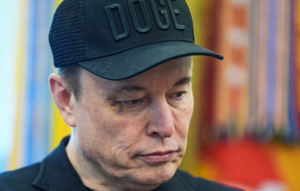 U shfaq me sy të nxirë në krah të Trump, Musk zbulon se kush e goditi me grusht