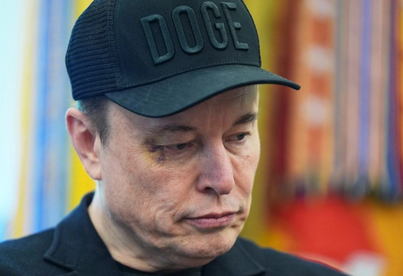 U shfaq me sy të nxirë në krah të Trump, Musk zbulon se kush e goditi me grusht