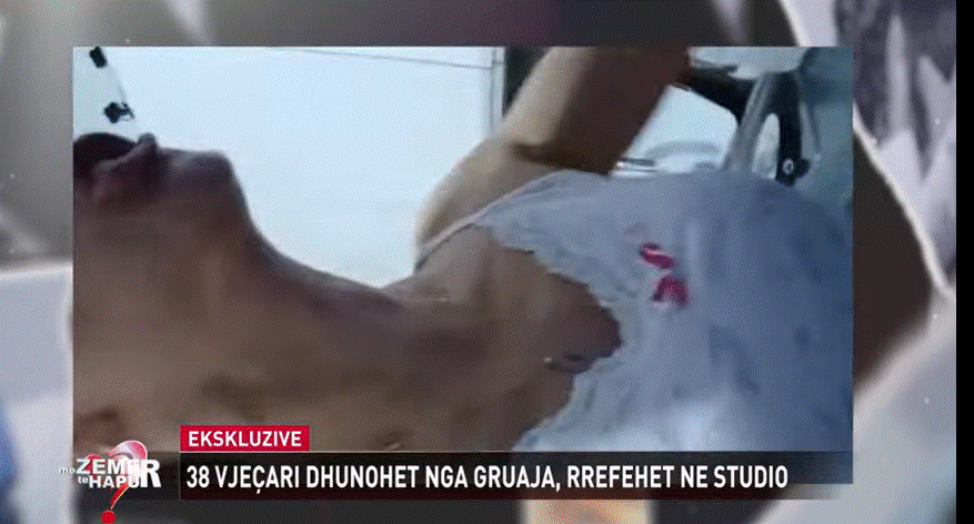 Video/ Gruaja “rreh” burrin, publikohen pamjet! Ish-bashkëshorti: Dyshoja se më tradhtonte