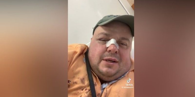 “Pse bëni zhurmë në lokal?”/ Zbulohet arsyeja pse u dhunua, Genard Hajdini dhe babai i tij