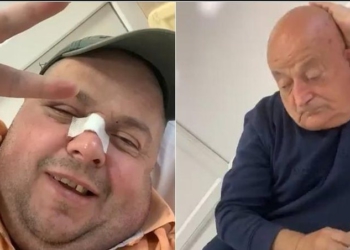 Goditi me grusht Genard Hajdinin dhe babain e tij, nis hetimi për 40-vjeçarin dhe 25-vjeçaren që e shoqëronte
