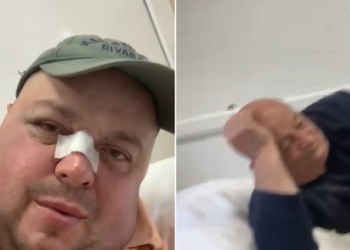 Personazhi i njohur i rrjeteve sociale dhe babai i tij rrihen brutalisht, përfundojnë në spitalin e Traumës