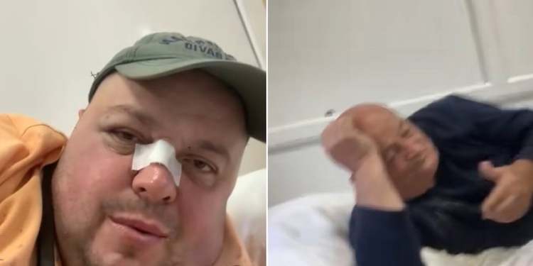 Personazhi i njohur i rrjeteve sociale dhe babai i tij rrihen brutalisht, përfundojnë në spitalin e Traumës