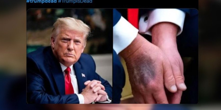 “Trump ka vdekur”, spekulimi që u përhap me shpejtësi në rrjet. Çfarë ndikoi?