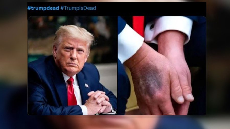 “Trump ka vdekur”, spekulimi që u përhap me shpejtësi në rrjet. Çfarë ndikoi?