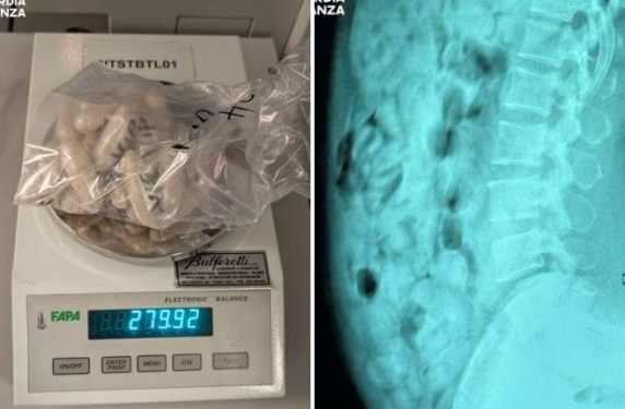 Nga tregtare veshjesh në trafikante! Çfarë i gjetën në stomak 46-vjeçares në aeroportin e Italisë