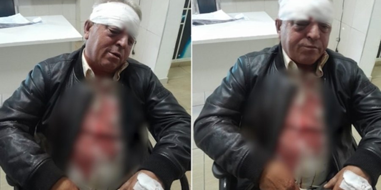 Punonjësi i Ndërmarrjes së Pastrimit dhunohet barbarisht, rrezikon shikimin në syrin e djathtë (Detajet)