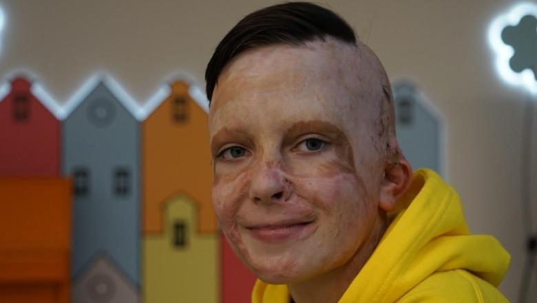 VIDEO- Rrëfimi prekës i 11-vjeçarit ukrainas përlot sallën në Parlamentin Europian/ Raketat ruse i vranë nënën në spital!