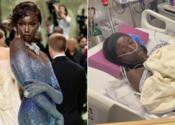 “Kuptova shpejt se nuk kishe kohë të duhur”, supermodelja ndan betejën e heshtur për shëndetin