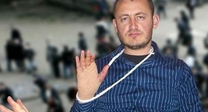 Gazetari i plagosur në ’21 Janar’: Berisha drejt arrestimit, laku po i ngushtohet!