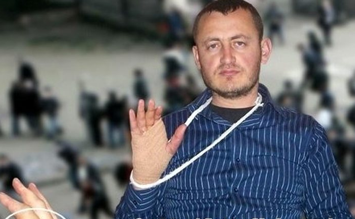 Gazetari i plagosur në ’21 Janar’: Berisha drejt arrestimit, laku po i ngushtohet!