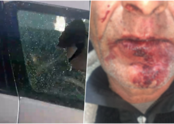 U dhunuan brenda makinës, gruaja tregon si ndodhi ngjarja: Jemi ngujuar në shtëpi nga frika