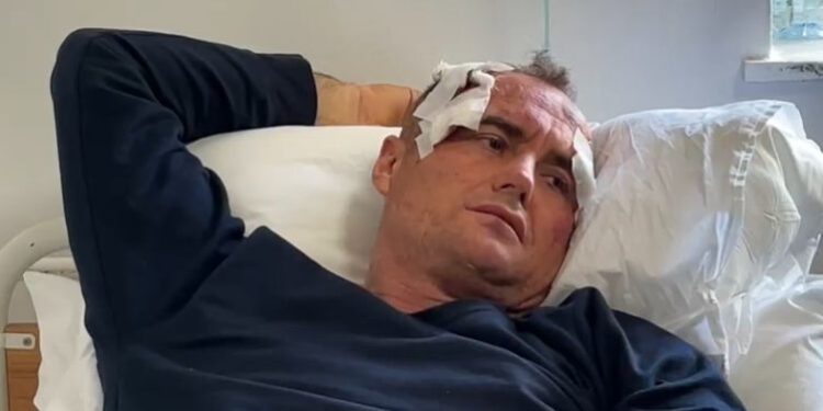 I riu dhunohet nga polici në Fier: I komentova motrës së tij në Facebook je bërë shumë e bukur