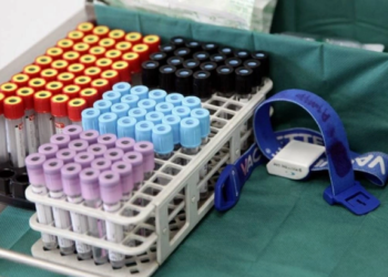 OBSH: Rreziku i përhapjes së virusit Nipah përtej Indisë është i ulët