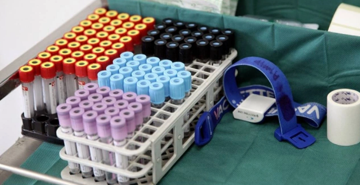 OBSH: Rreziku i përhapjes së virusit Nipah përtej Indisë është i ulët