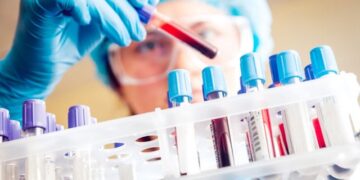 47-vjeçarja shqiptare në Itali humb jetën pas diagnozës së gabuar, familja dëmshpërblehet me 300 mijë euro