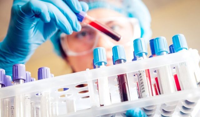 47-vjeçarja shqiptare në Itali humb jetën pas diagnozës së gabuar, familja dëmshpërblehet me 300 mijë euro