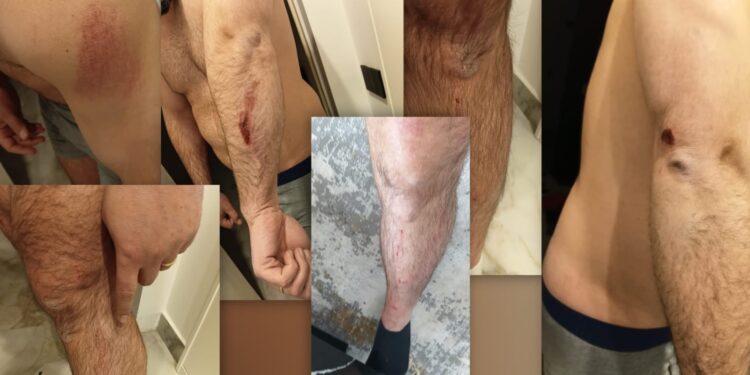 FOTO / Protestuesit e Rrjollit rrahin brutalisht pas emisionit djalin e trashëgimtarit të tokës