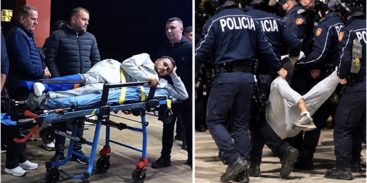 Protesta/ Ministria e Shëndetësisë: 6 të lënduar te ‘Trauma’, njëri po i nënshtrohet operacionit