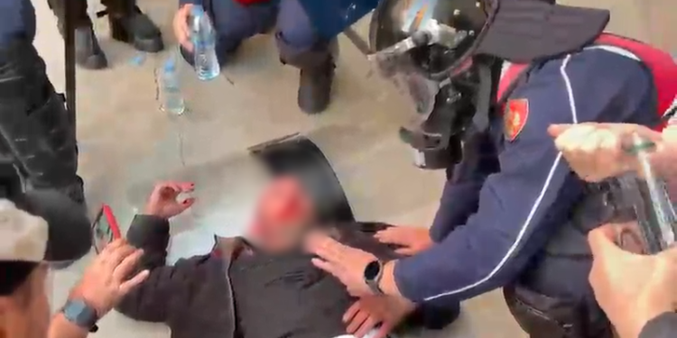 “Shyqyr që dole gjallë!”/ Momenti kur Policia shpëton qytetarin e dhunuar nga protestuesit e maskuar