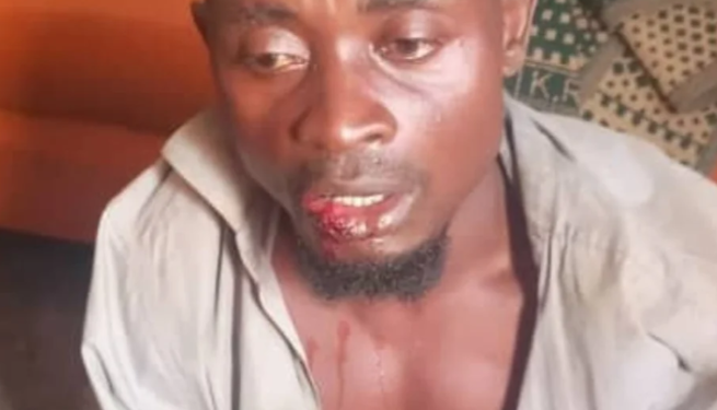 15 vite në arrati, arrestohet në Ugandë i dyshuari për vrasjen e 38 personave dhe kanibalizëm