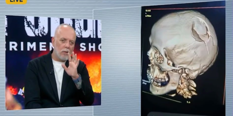VIDEO / Rezonanca e policit të goditur në Shkodër: Protestuesit i thyen kafkën dhe…